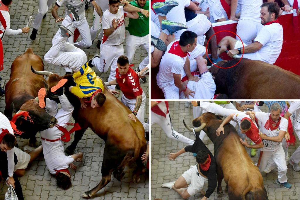 Schokkende foto's tonen het gescheurde been van een man uit Florida in een stierenrennen in Pamplona