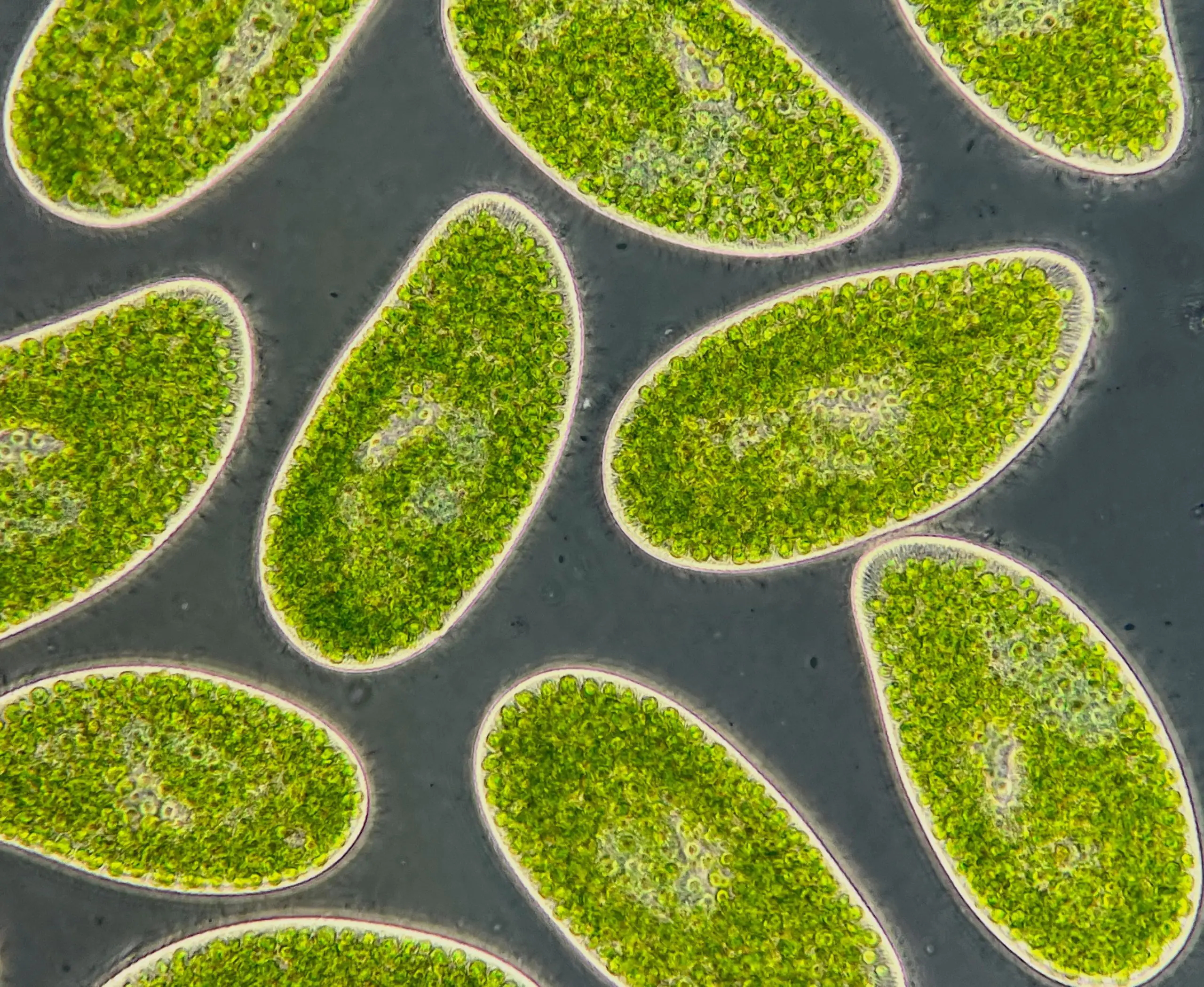 Onbekende microben kunnen een vroeg waarschuwingssignaal zijn voor een klimaatomslagpunt