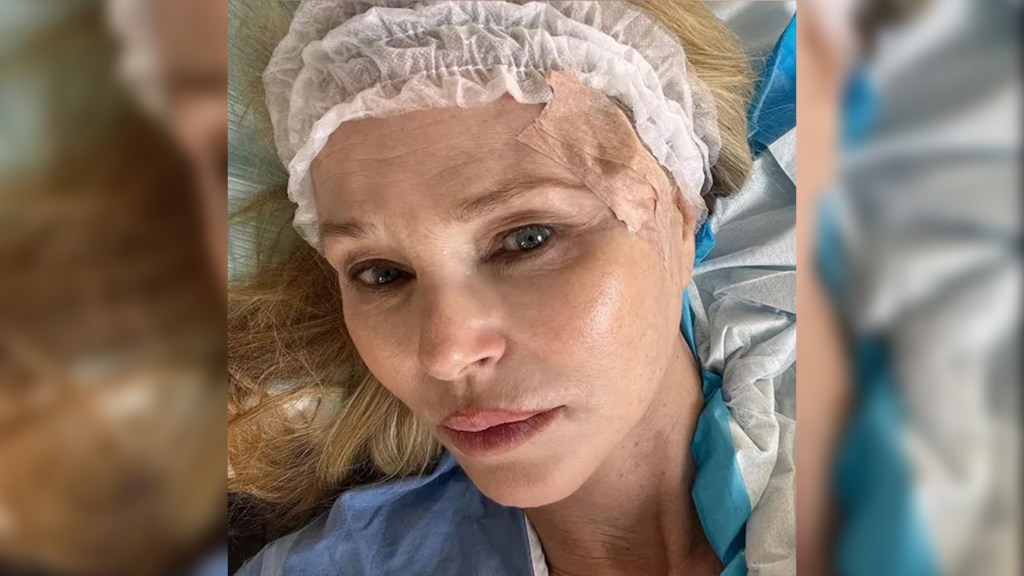 Christie Brinkley deelt foto's van behandelingsprocedures voor huidkanker en promoot 'zonbescherming'