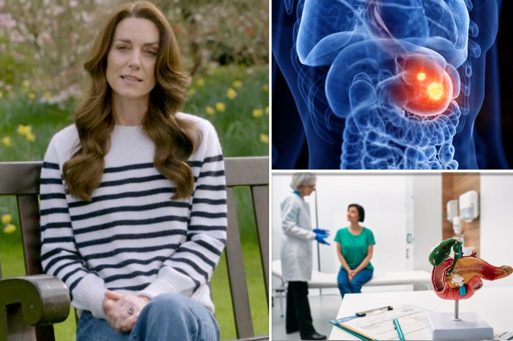 De diagnose van Kate Middleton komt te midden van een ‘epidemie’ van kanker in een vroeg stadium