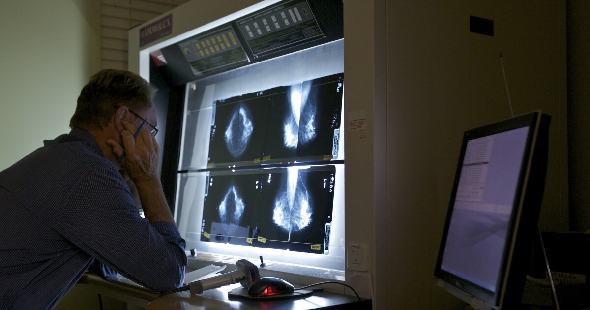 Artsen uit Pennsylvania zeggen dat mammografieën kunnen worden gebruikt om hartziekten bij vrouwen in een vroeg stadium op te sporen