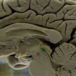 De meeste Amerikanen hechten waarde aan de gezondheid van de hersenen, maar uit een nieuw Alzheimer-rapport blijkt dat weinigen weten hoe ze deze kunnen beschermen