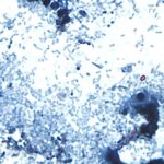 11 gevallen van cyclosporiasis in Allegheny County terwijl federaal onderzoek de oorsprong blijft volgen