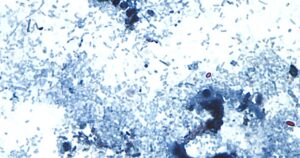 11 gevallen van cyclosporiasis in Allegheny County terwijl federaal onderzoek de oorsprong blijft volgen