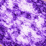 Zesde sterfgeval als gevolg van mazelen gemeld in Franklin County nu de uitbraak in Pennsylvania toeneemt