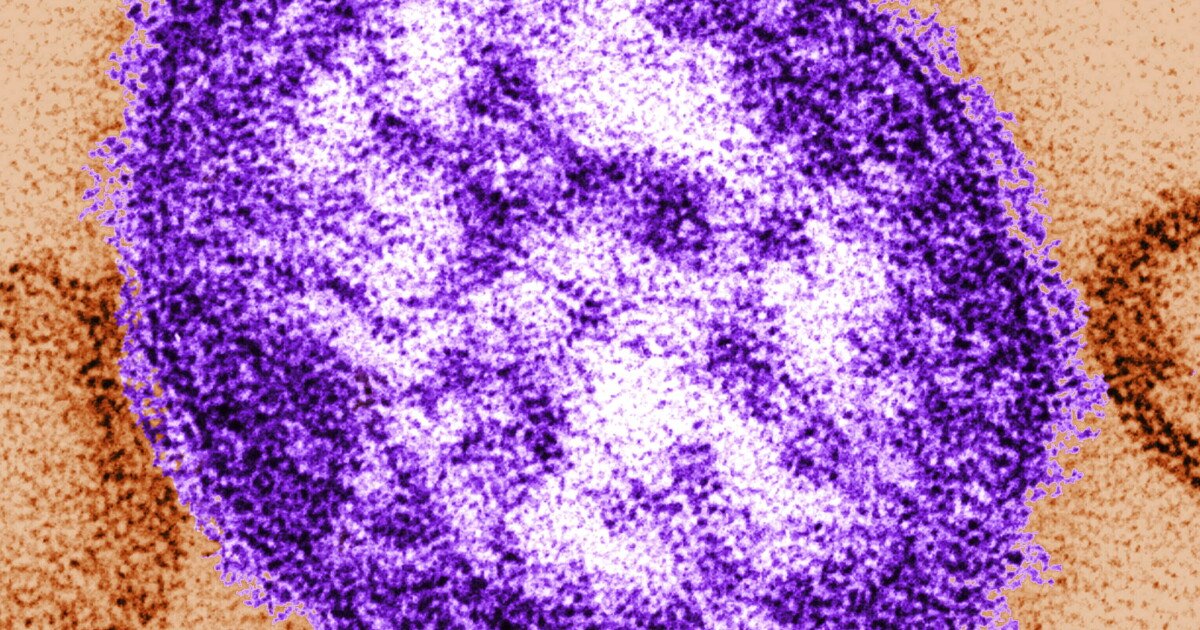 Zesde sterfgeval als gevolg van mazelen gemeld in Franklin County nu de uitbraak in Pennsylvania toeneemt